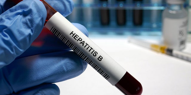 Blood vial marked with Hepatitis B.