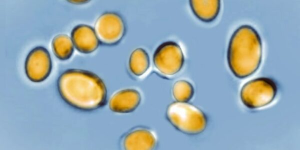 Frightening new fungus ‘candida auris’: What is it? Who is susceptible?